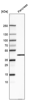 Western blot analysis in human pancreas tissue.