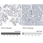 Anti-TET2 Antibody