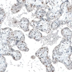 Immunohistochemical staining of human placenta shows moderate nuclear positivity in a subset of trophoblastic cells.
