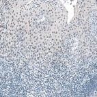 Immunohistochemical staining of human tonsil shows weak to moderate nuclear positivity in squamous epithelial cells.