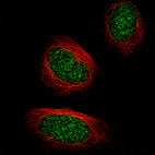 Anti-TET2 Antibody