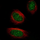 Immunofluorescence staining of U-2 OS cells using the Anti-TET2 monoclonal antibody, showing specific staining in the nucleus in green. Microtubule- and nuclear probes are visualized in red and blue, respectively (where available).