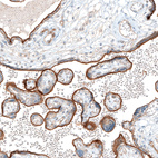 Immunohistochemical staining of human placenta shows strong apical membrane positivity in trophoblastic cells.