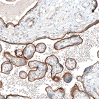 Immunohistochemical staining of human placenta shows strong apical membrane positivity in trophoblastic cells.