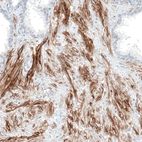 Immunohistochemical staining of human prostate shows moderate to strong membranous positivity in smooth muscle cells.