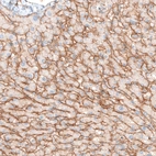 Immunohistochemical staining of human liver shows moderate positivity in liver sinusoids.