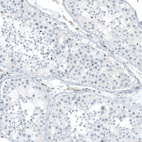 Anti-ITGA5 Antibody