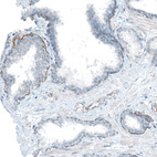 Immunohistochemical staining of human prostate shows weak to moderate basement membrane positivity in glandular cells.