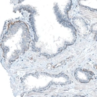 Immunohistochemical staining of human prostate shows weak to moderate basement membrane positivity in glandular cells.