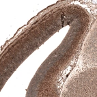 Immunohistochemical staining of mouse embryo E14 shows moderate nuclear positivity in neuronal cells of developing cerebral cortex.