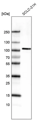 Western blot analysis in human cell line SCLC-21H.