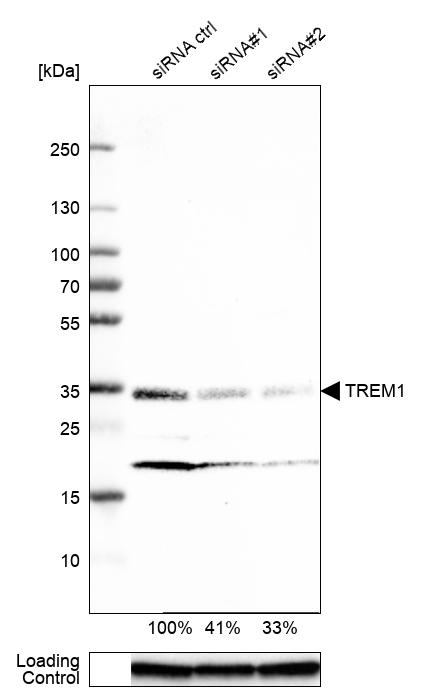 Anti-TREM1 Antibody