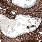 Immunohistochemical staining of human prostate shows strong membranous positivity in smooth muscle cells.
