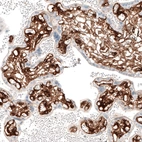 Immunohistochemical staining of human placenta shows strong membranous positivity in blood vessels and loose connective tissue of chorionic villi.