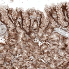 Immunohistochemical staining of human stomach shows moderate membranous positivity in glandular cells.