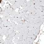 Immunohistochemical staining of human skeletal muscle shows no positivity in striated muscle fibers as expected.