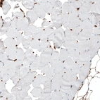 Immunohistochemical staining of human skeletal muscle shows no positivity in striated muscle fibers as expected.