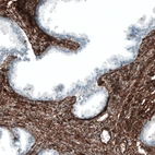 Immunohistochemical staining of human prostate shows strong membranous positivity in smooth muscle cells.