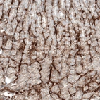 Immunohistochemical staining of human stomach shows moderate membranous positivity in glandular cells, as well as staining in basement membrane.