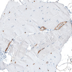 Immunohistochemical staining of human skeletal muscle shows no positivity in striated muscle fibers as expected.
