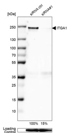 Western blot analysis in U-138MG cells transfected with control siRNA, target specific siRNA probe #1, using Anti-ITGA1 antibody. Remaining relative intensity is presented. Loading control: Anti-GAPDH.