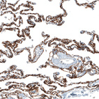 Immunohistochemical staining of human lung shows strong membranous positivity in pneumocytes.