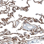 Immunohistochemical staining of human lung shows strong membranous positivity in pneumocytes.