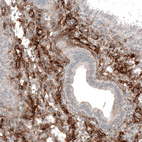 Immunohistochemical staining of human endometrium shows strong membranous positivity in smooth muscle cells.