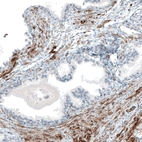 Immunohistochemical staining of human prostate shows moderate to strong positivity in smooth muscle cells.