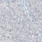 Immunohistochemical staining of human pancreas shows no positivity in exocrine glandular cells as expected.