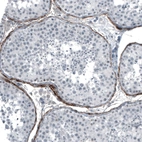 Immunohistochemical staining of human testis shows moderate positivity of secretion around peritubular myoid cells.