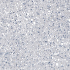Immunohistochemical staining of human liver shows no positivity in hepatocytes as expected.