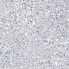 Immunohistochemical staining of human liver shows no positivity in hepatocytes as expected.