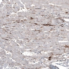 Immunohistochemical staining of human heart muscle shows strong positivity of secretion around cardiomyocytes.