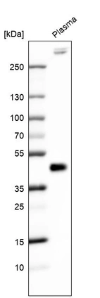 Western blot analysis in human plasma.