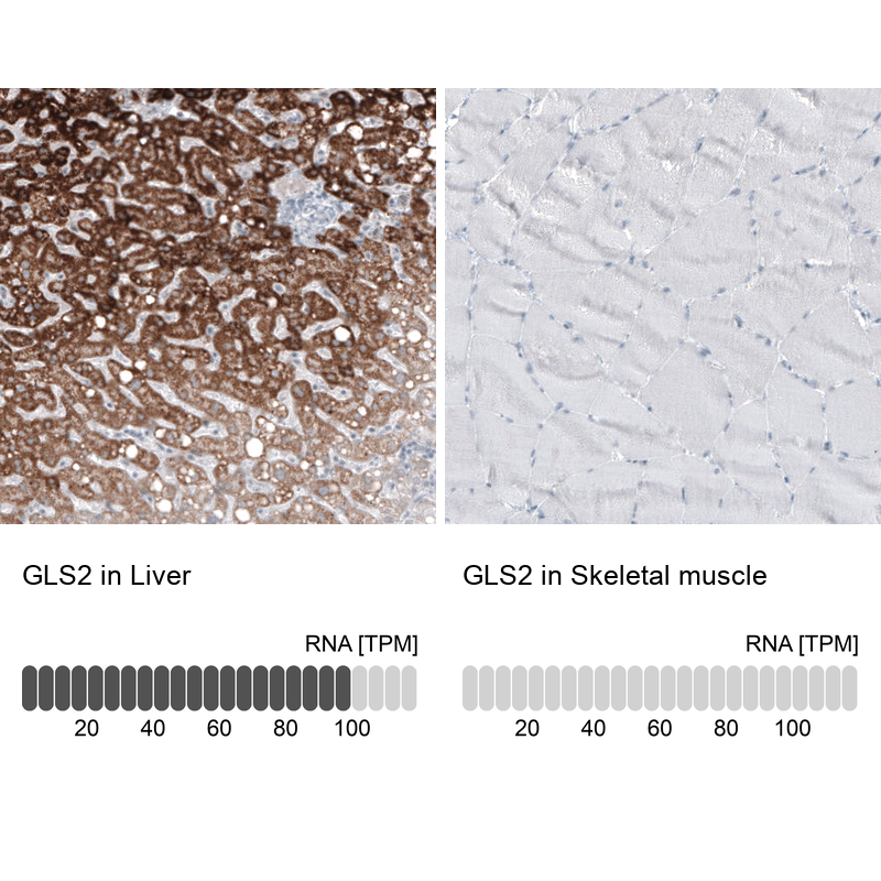 Anti-GLS2 Antibody