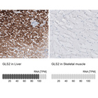Anti-GLS2 Antibody