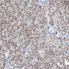 Immunohistochemical staining of human pancreas shows moderate granular cytoplasmic positivity in exocrine glandular cells.