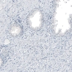 Immunohistochemical staining of human prostate shows no positivity in glandular cells as expected.