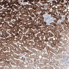 Immunohistochemical staining of human liver shows strong granular cytoplasmic positivity in hepatocytes.