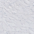 Immunohistochemical staining of human skeletal muscle shows no positivity in myocytes as expected.