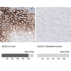 Anti-GLS2 Antibody