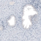 Immunohistochemical staining of human prostate shows no positivity in glandular cells as expected.
