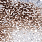 Immunohistochemical staining of human liver shows strong granular cytoplasmic positivity in hepatocytes.