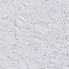 Immunohistochemical staining of human skeletal muscle shows no positivity in myocytes as expected.