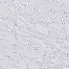 Immunohistochemical staining of human skeletal muscle shows no positivity in myocytes as expected.