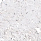 Immunohistochemical staining of human skeletal muscle shows no positivity in myocytes as expected.