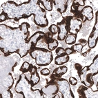Immunohistochemical staining of human placenta shows strong cytoplasmic positivity in trophoblastic cells.