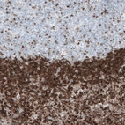 Immunohistochemical staining of human lymph node shows strong cytoplasmic positivity in non-germinal center cells.