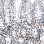 Immunohistochemical staining of human rectum shows strong cytoplasmic positivity in lymphoid cells.